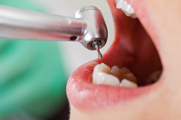 Best Emergency Treatment for Toothache in Loxley, AL